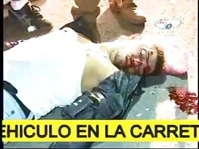 SERIOUSLY INJURED, RIDER PUKES AFTER ACCIDENT