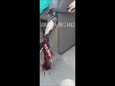 MAN WITH HORRIBLE LEG INJURY CALMALLY SPEAKING ON THE CELL PHONE