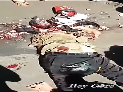 HE WAS CRUSHED IN AN ACCIDENT