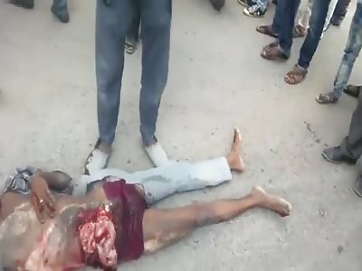 DEAD IN ACCIDENT AND GUTS EXPOSED