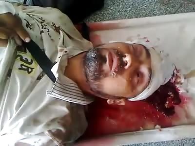 HOLE IN HEAD AND DYING