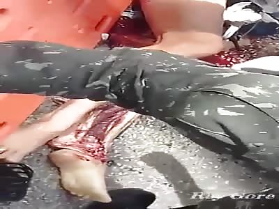 LEG FUCKED UP SHOWING TENDONS AND MUSCLES