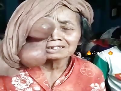 THERE IS ALWAYS SOMEONE WORSE THAN YOU - 25