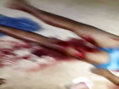 MAN INJURED BY SICKLE