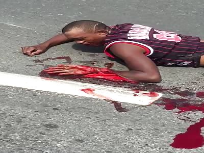 HORRIBLE AFTERMATH OF AN ACCIDENT