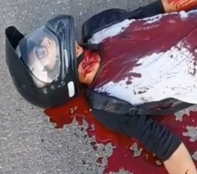 HE'S NECK WAS SLICED BY THE KITE LINE