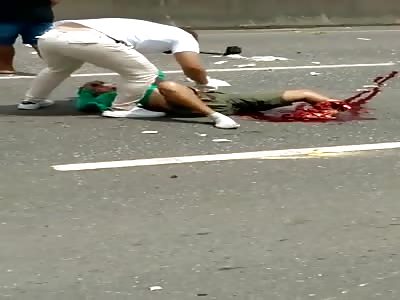 LEG CRUSHED IN AN ACCIDENT 