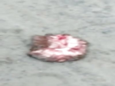 SHOCKING AFTERMATH OF MOTORCYCLE ACCIDENT 