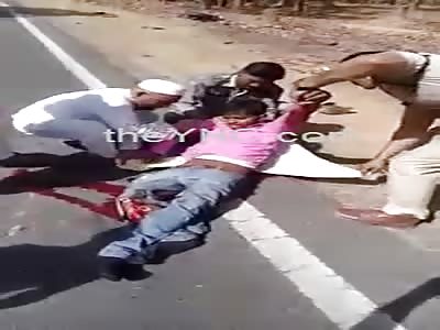 Motociclyst Leg Fucked In Accident