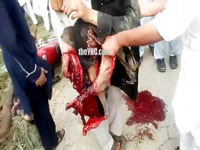 Terrible Accident: Kid With Feet Destroyed