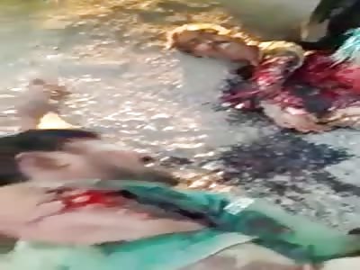 Terrible Accident Dude Literally Twisted Around Wheel