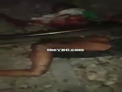 Accident In Train Lines.