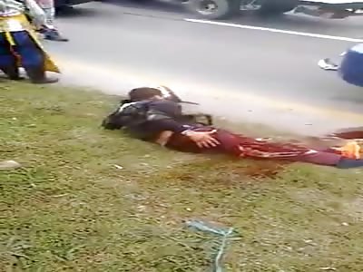 Total Agony: Man With Horrific Open Leg 