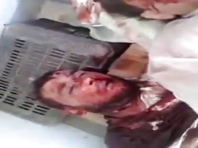  A man with a hollow head