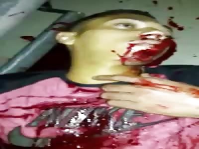 Agonizing after crashing