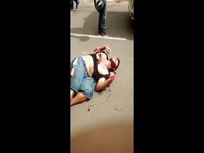 Motorcycle accident (full verdict)