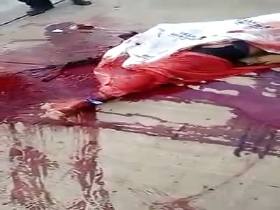 Nice pictures of man without foot