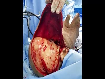 Beautiful face surgery  (nice)