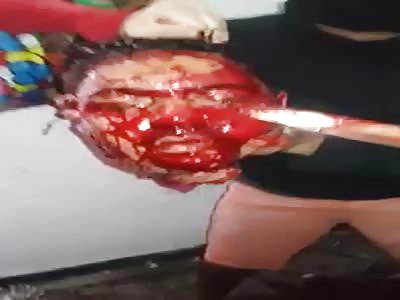 :) Playing with the head