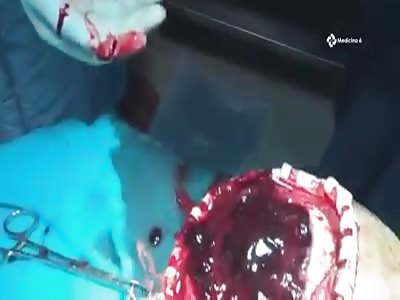 Checking your graphic head