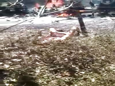 Man burned in accident