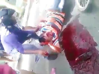 Man goes without a face after an accident