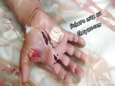 Hand cleaning of  fap 