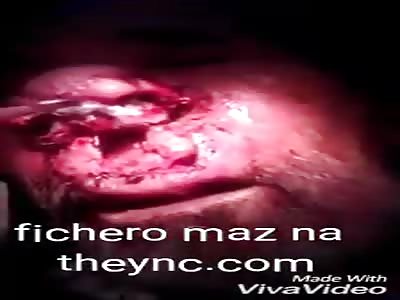 You will rot your nose by consuming poor quality cocaine part 3