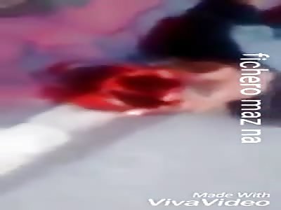 *The brain was shot*