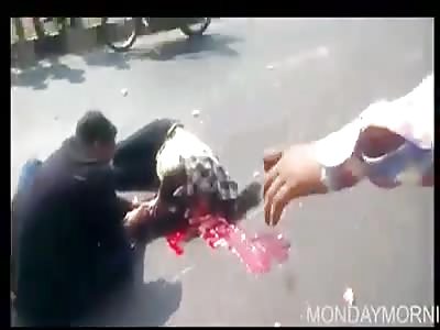 Woman with head shattered