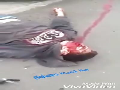 Terrible accident leaves wounded agonizing