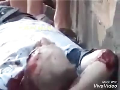  People injured after a fatal accident