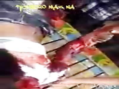 Man with broken legs