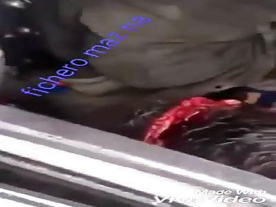 Man dies in accident without brain