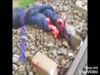 Man loses his legs in suicide attempt