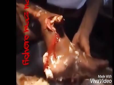 Terrible wound you see the bone