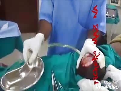 Incredible operation of damaged prostate