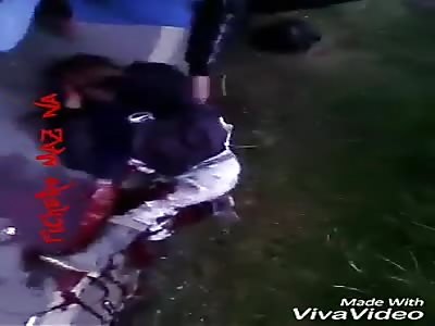 Man screams in pain after accident (2)