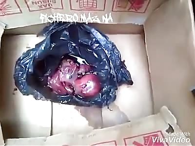 When your mother does not love you