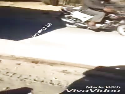 Leg totally shattered