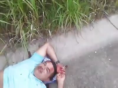 One dead and injured in an accident