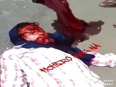 Agonizing after an accident