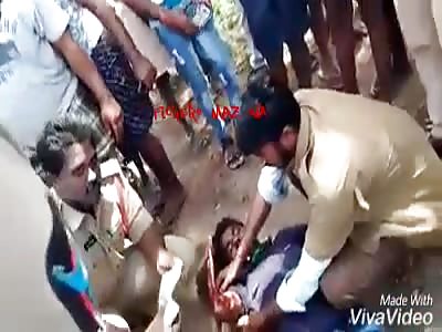 Man loses his hand (now he can not masturbate how sad)