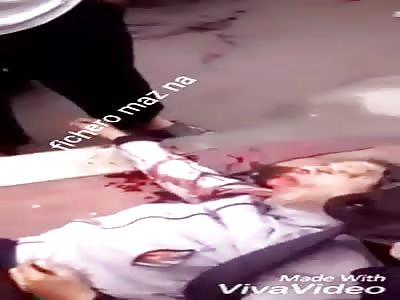 Sticking out his tongue after an accident