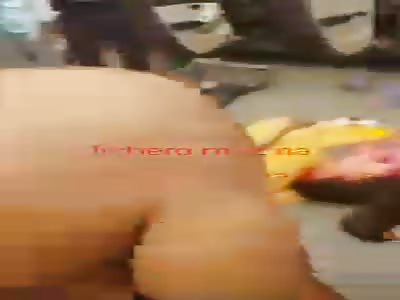 Woman loses part of the scalp in accident