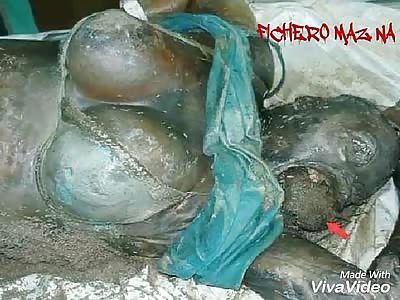 Woman with newborn full of worms