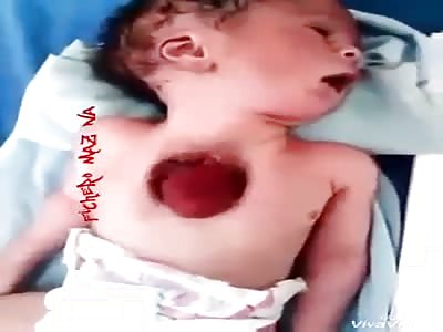(Shocking) very sad has the heart outside beating