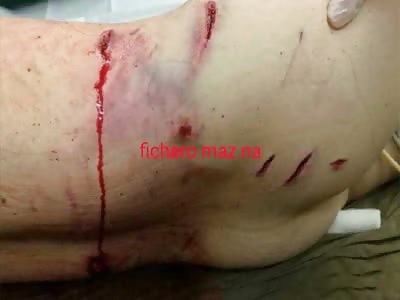 Woman attacked by tiger