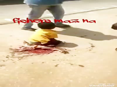 Shocking Video shows boy with shattered leg