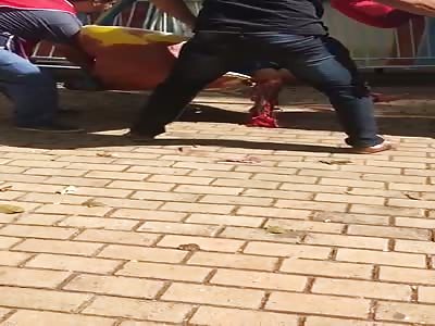 Woman left with shattered leg in accident of fair